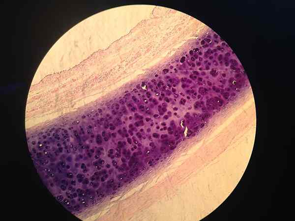 Perbezaan antara acidophilic dan basophilic