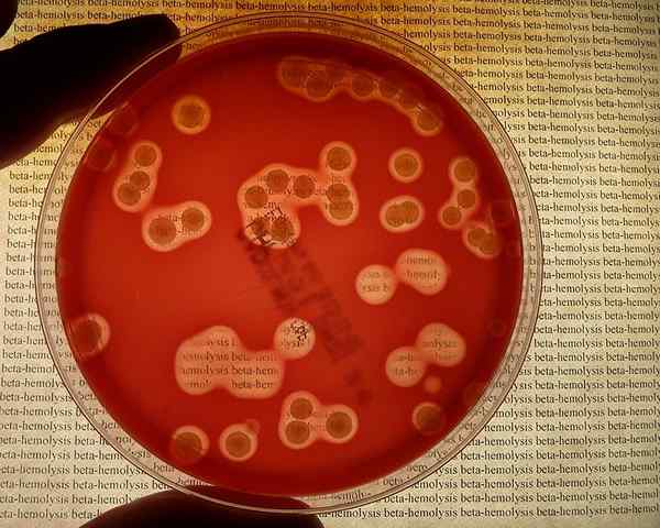 Perbedaan antara hemolisis alpha dan beta