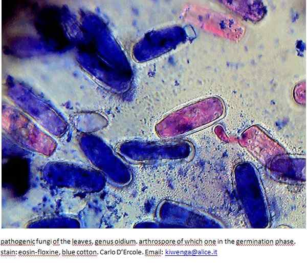 Différence entre les arthrospores et le chlamydospore