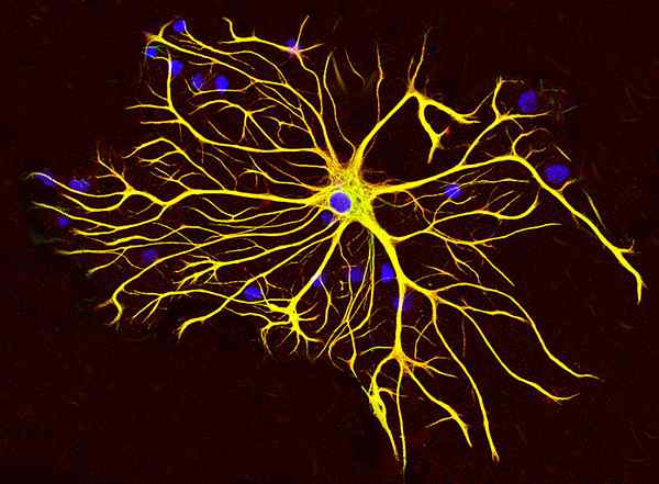 Perbezaan antara astrocytes dan oligodendrocytes