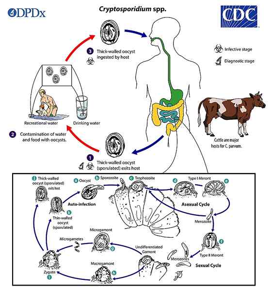 Diferencia entre autoinfección e hiperinfección