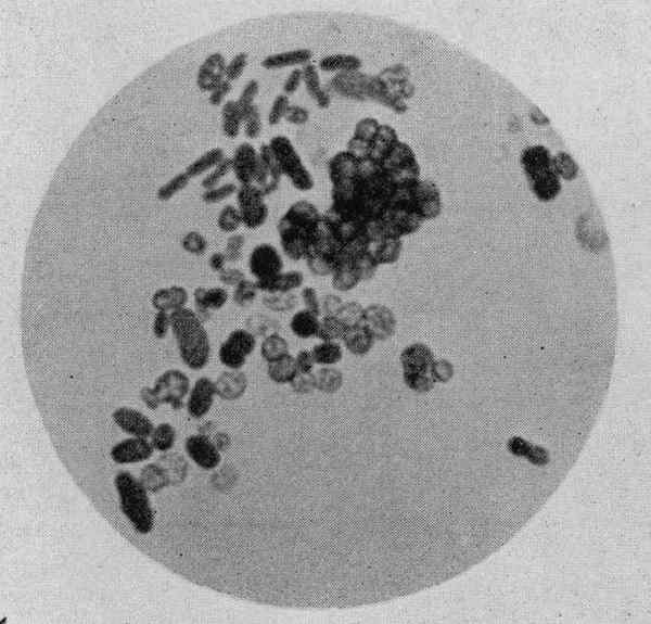 Perbezaan antara Azotobacter dan Azospirillum