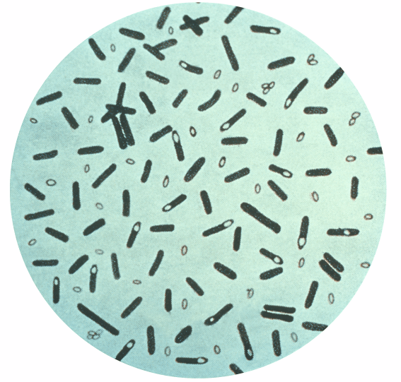 Diferencia entre Bacillus y Clostridium