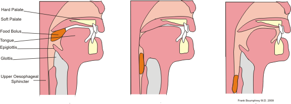 Différence entre le bolus et le chyme