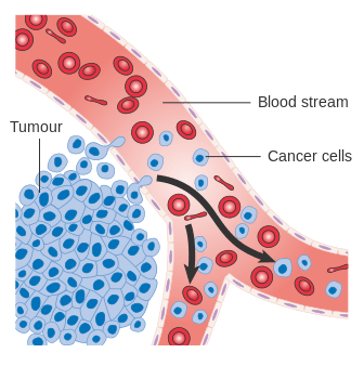 Différence entre le cycle des cellules cancéreuses et le cycle cellulaire normal