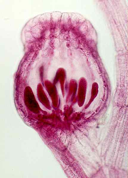 Perbedaan antara carposporophyte dan tetrasporophyte