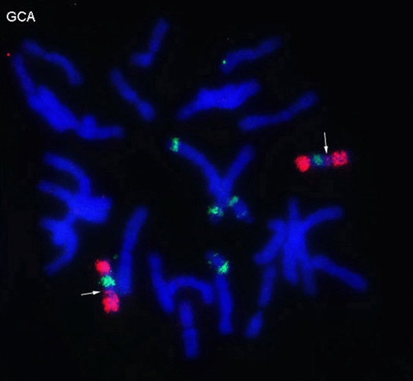 Différence entre le banque chromosomique et la peinture chromosomique