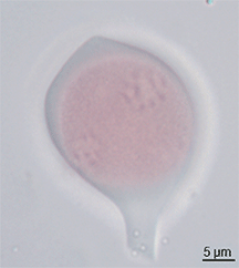 Perbedaan antara coenocytic dan heterotrichous