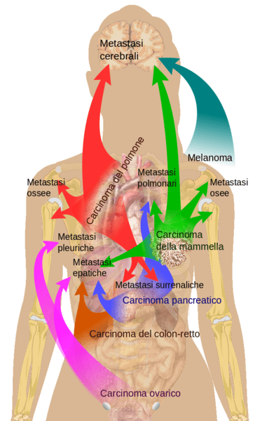 Perbezaan antara perencatan hubungan dan metastasis