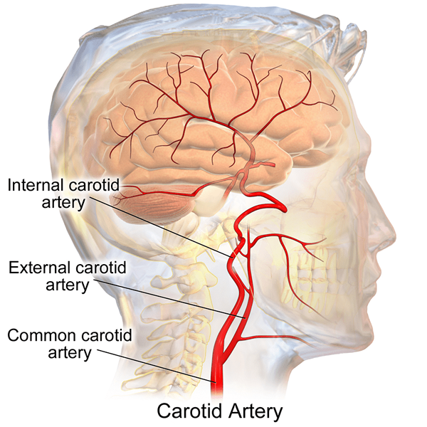 Diferencia entre la arteria coronaria y carótida