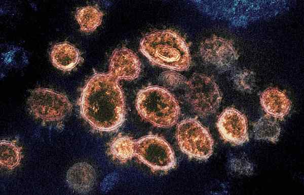 Perbezaan antara coronavirus dan covid 19