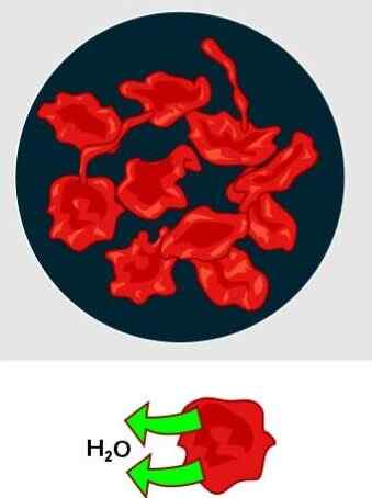 Différence entre création et plasmolyse