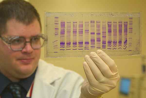 Perbedaan antara DNA dan pengujian ayah