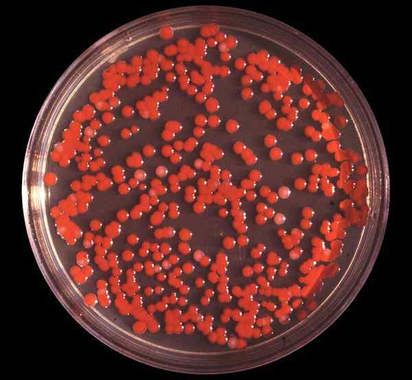 Unterschied zwischen E coli und Serratia marcescens