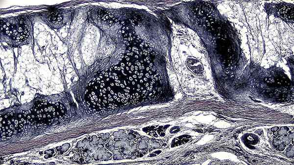 Différence entre le cartilage élastique et le cartilage hyalin