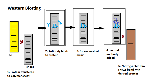 Différence entre Elisa et Western blot