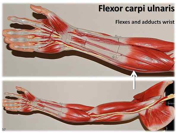 Diferencia entre los músculos flexores y extensores