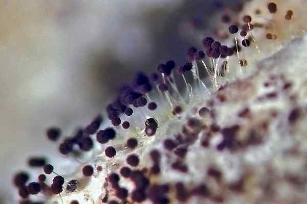 Perbedaan antara jamur dan protozoa