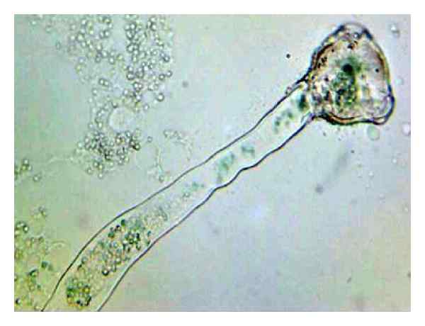 Unterschied zwischen generativem Kern und Pollenröhrchenkern