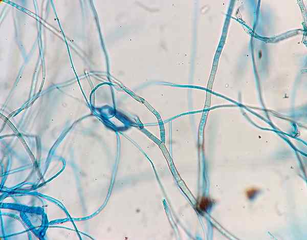 Perbezaan antara hyphae dan pseudohyphae