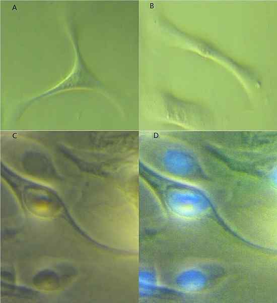 Diferencia entre queratinocitos y corneocitos