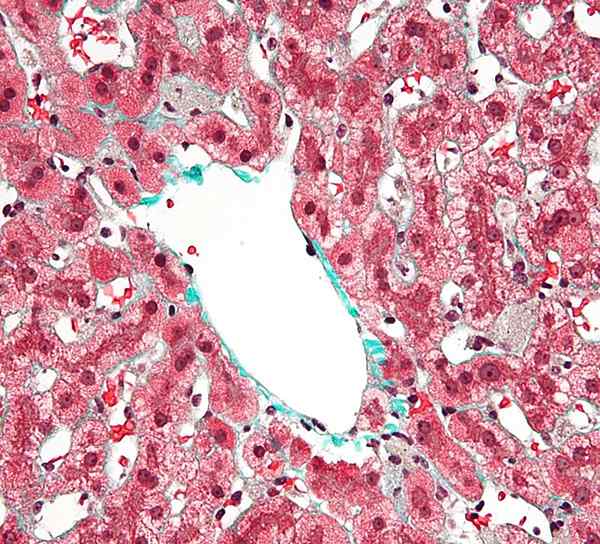 Différence entre les cellules Kupffer et les hépatocytes