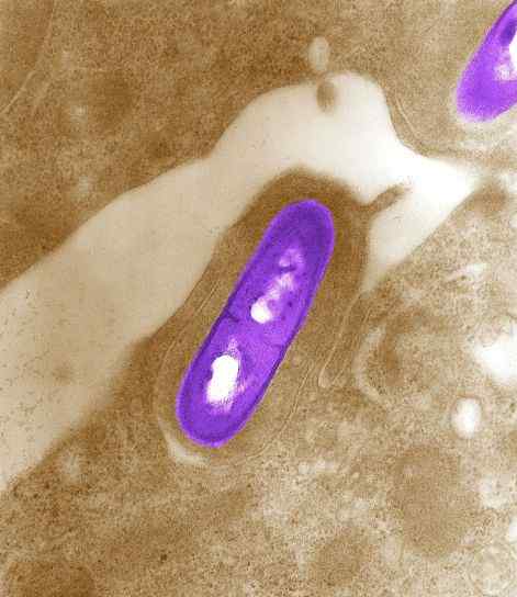 Différence entre Listeria monocytogenes et Listeria spp