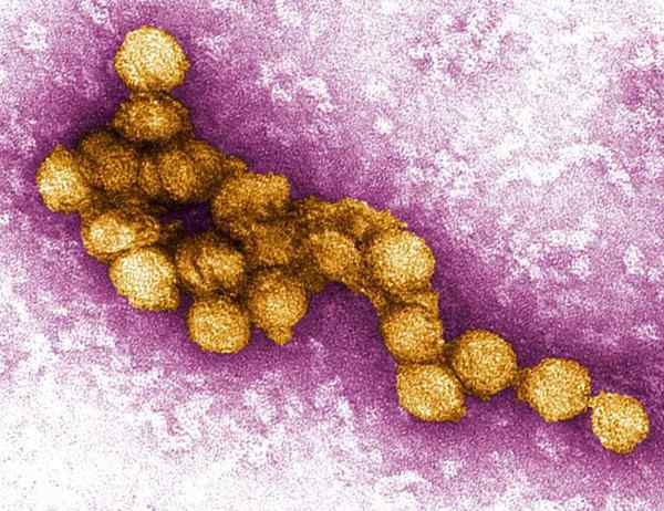 Perbezaan antara virus malaria dan West Nile