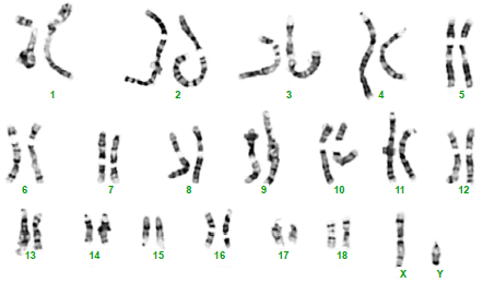 Perbezaan antara karyotypes lelaki dan perempuan