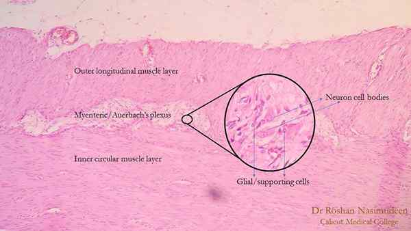 Perbezaan antara plexus Meissner dan Auerbach