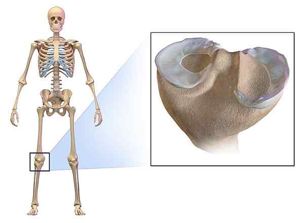 Diferencia entre menisco y ligamento