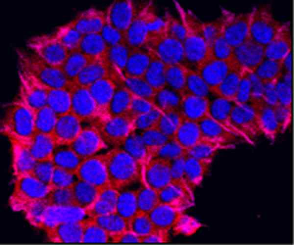 Perbezaan antara penanda mesenchymal dan penanda sel stem