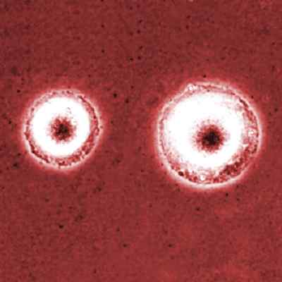 Perbezaan antara mycoplasma dan klamidia
