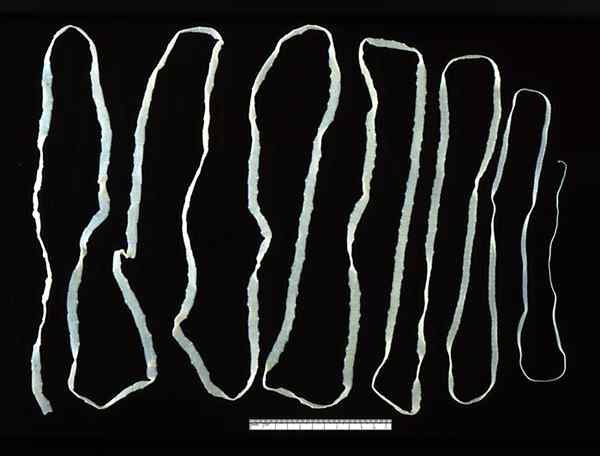 Perbedaan antara planarian dan cacing pita