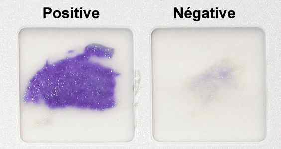 Unterschied zwischen positivem und negativem Oxidase -Test