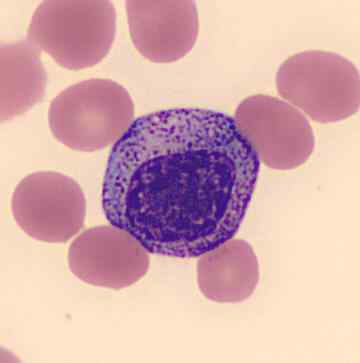 Perbezaan antara promyelocyte dan myelocyte