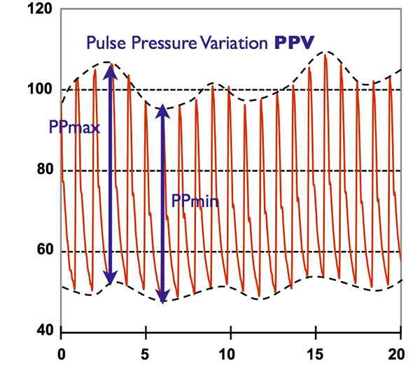 Diferencia entre la presión de pulso y pulso
