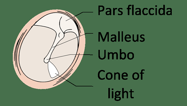 Différence entre la membrane tympanique droite et gauche