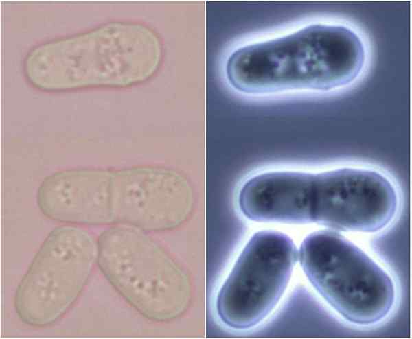 Unterschied zwischen Saccharomyces cerevisiae und Schizosaccharomyces pombe