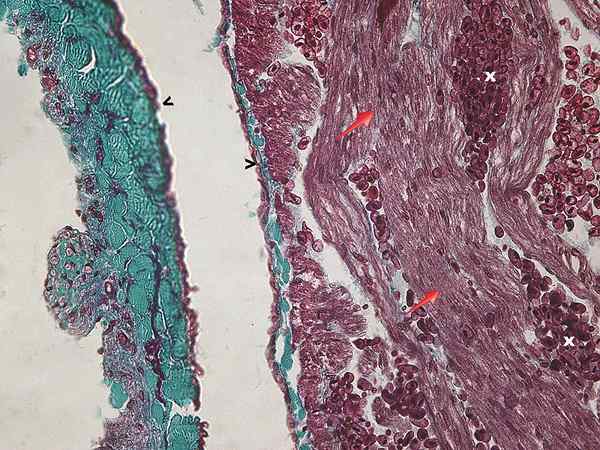 Perbezaan antara sinus venosus dan conus arteriosus