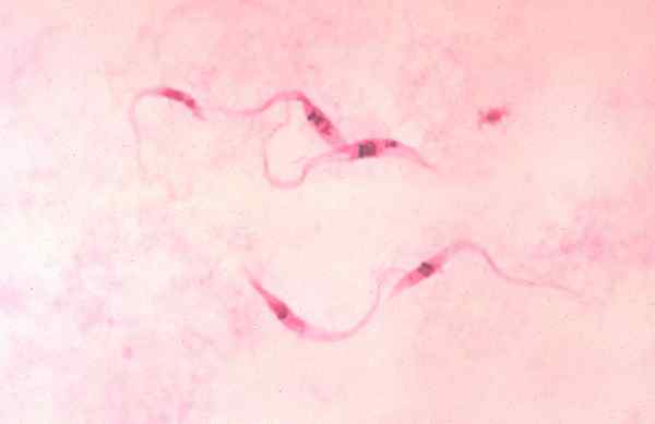 Diferencia entre Trypanosoma Cruzi y Trypanosoma rangeli