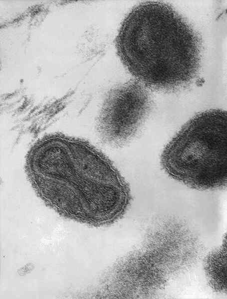 Diferencia entre vaccinia y virus de variola