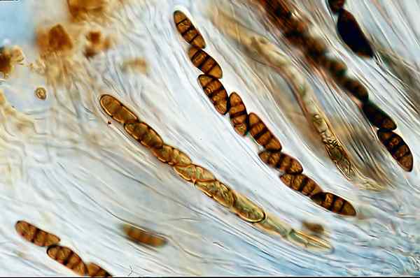 ¿Cuál es la diferencia entre ascosporas y conidios?
