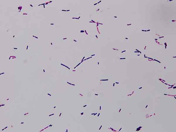 Apa perbedaan antara Bacillus cereus dan Bacillus thuringiensis
