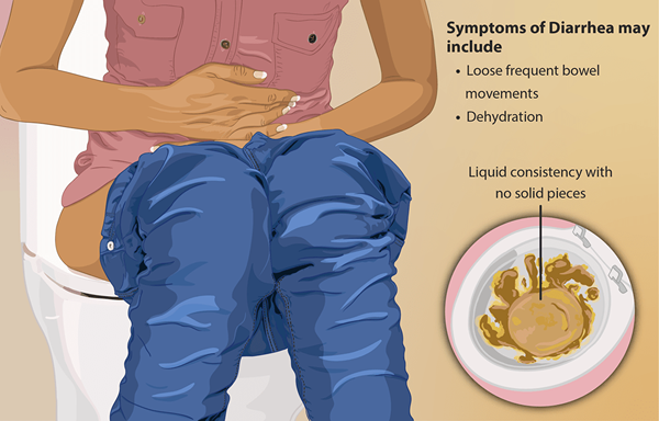 Quelle est la différence entre la constipation et la diarrhée