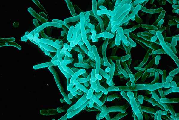 ¿Cuál es la diferencia entre corynebacterium diphteroee y difteroides?