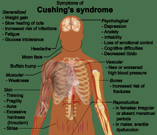 ¿Cuál es la diferencia entre el síndrome de la enfermedad de Cushings y Cushings?