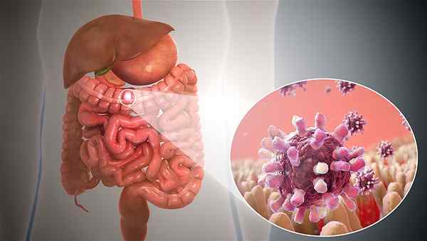 Apa perbedaan antara diare dan gastroenteritis