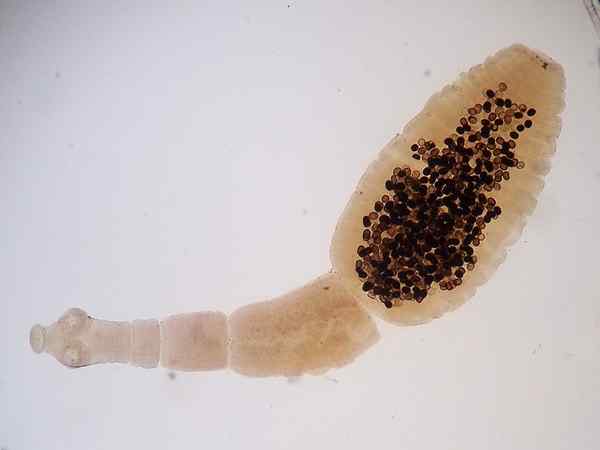 Apa perbedaan antara Echinococcus granulosus dan multilocularis