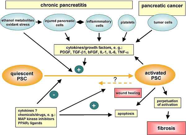 ¿Cuál es la diferencia entre gastritis y pancreatitis?